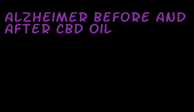 Alzheimer before and after CBD oil