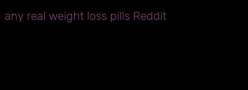 any real weight loss pills Reddit