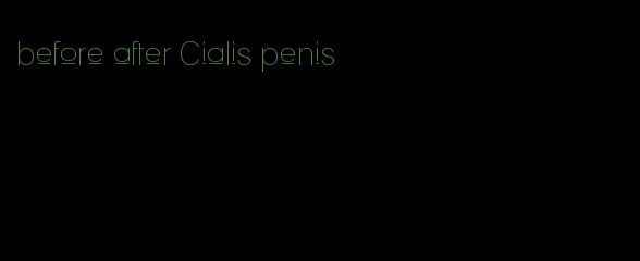 before after Cialis penis