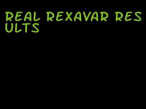 real RexaVar results